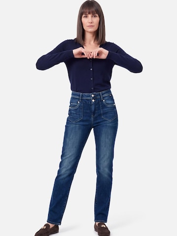M.O.D MIRACLE OF DENIMregular Traperice - plava boja: prednji dio