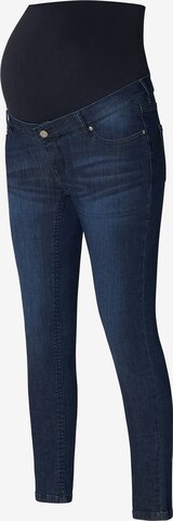 Noppies Skinny Jeans 'Avi' in Blauw: voorkant