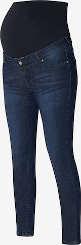 Skinny Jeans 'Avi' di Noppies in blu: frontale