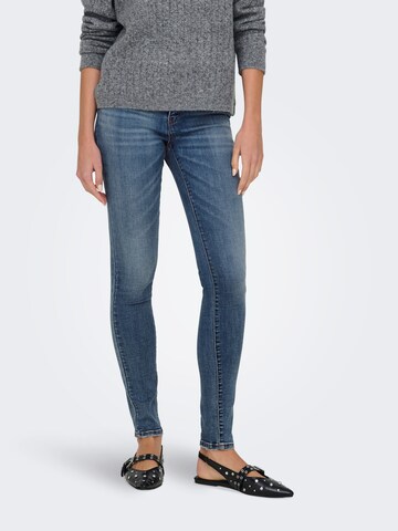 Slimfit Jeans di ONLY in blu: frontale