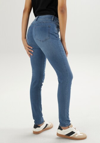 Aniston SELECTED Skinny Jeans in Blue