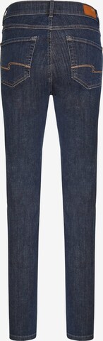 Angels Skinny Jeans in Blue: front