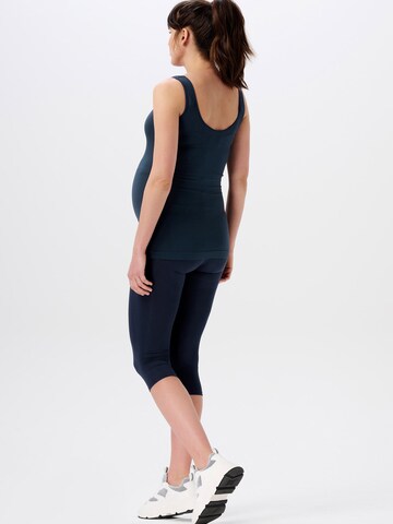 Skinny Leggings 'Ales' Noppies en bleu