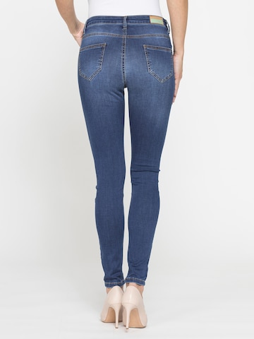 Carrera Jeans Skinny Jeans '5-Pocket Legg'‌‌‌‌‌‌‌ in Blau