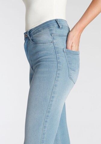 ONLY Skinny Jeans in Blue