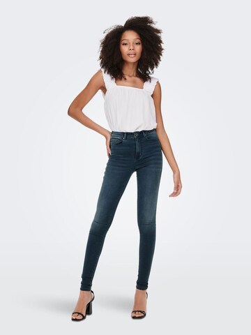 ONLY Skinny Jeans 'Royal' in Blauw