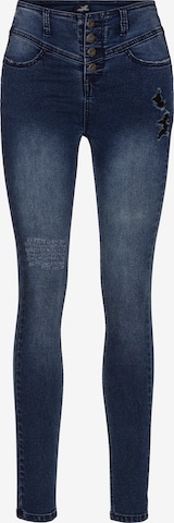 ARIZONA Skinny Jeans in Blau: predná strana