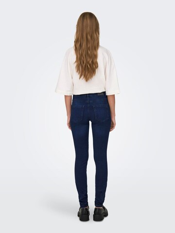 ONLY Skinny Jeans 'ROYAL' in Blauw