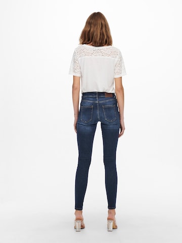 ONLY Skinny Jeans 'Blush' in Blau