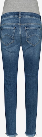 MAMALICIOUS Slimfit Jeans 'Mendez' in Blau