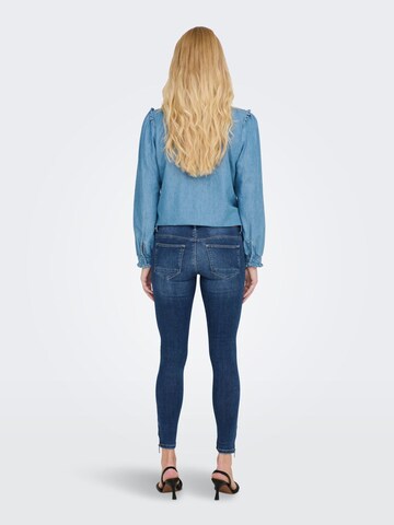 Only Maternity Skinny Jeans 'Kendell' in Blau