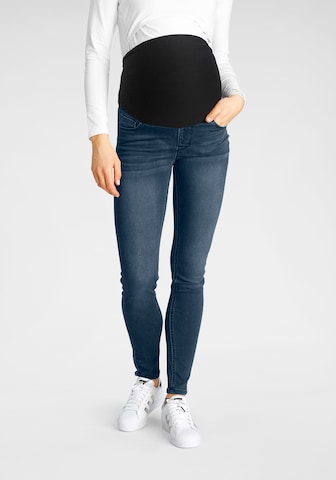 Neun Monate Skinny Jeans in Blue: front