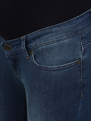 Envie de Fraise Skinny Jeans 'CLINT' in Blue