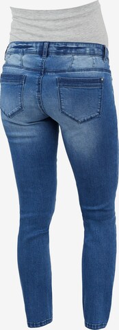 MAMALICIOUS Slimfit Jeans 'Nome' in Blauw