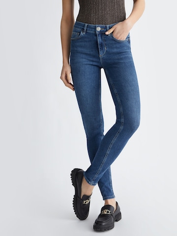 Liu Jo Skinny Jeans in Blau: predná strana