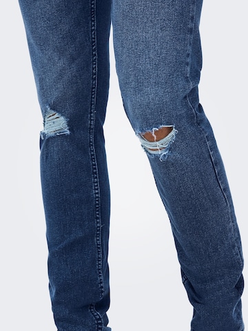 Only & Sons Slimfit Jeans 'Loom Life' in Blauw