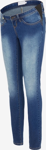MAMALICIOUS Slimfit Jeans 'Essa' in Blau: predná strana
