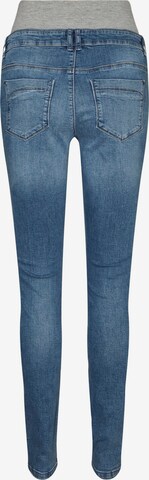 MAMALICIOUS Skinny Jeans 'Desota' in Blau