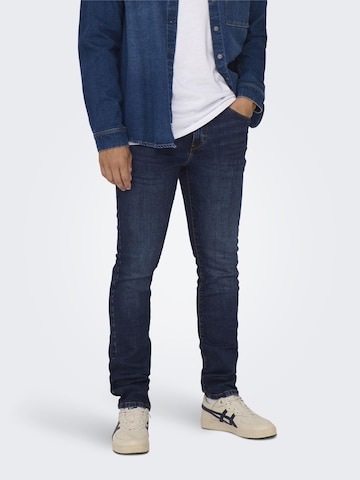 Skinny Jeans 'Loom' de la Only & Sons pe albastru: față