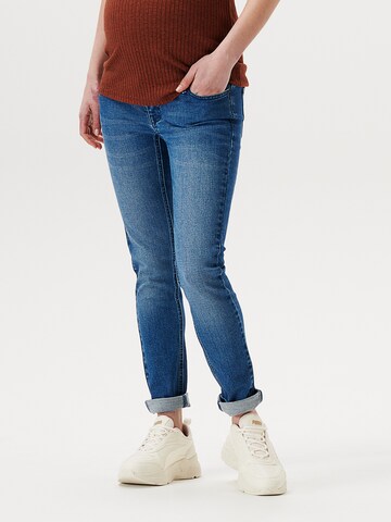 Supermom Skinny Fit Дънки 'Austin' в синьо: отпред