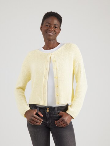 geltona Abercrombie & Fitch Kardiganas: priekis