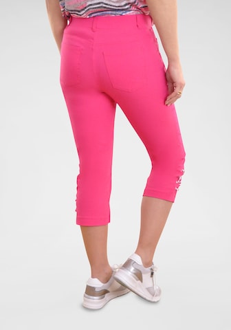 Navigazione Skinny Hose in Pink