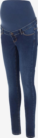 MAMALICIOUS Jeans 'Banda' in Blue: front