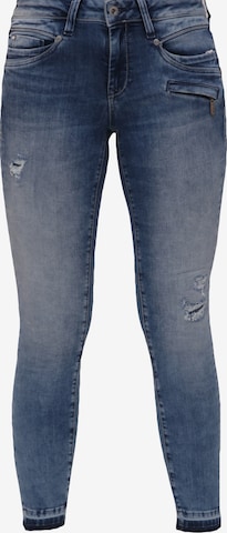 Miracle of Denim Skinny Jeans 'Suzy' in Blau: predná strana