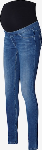 Noppies Skinny Jeans 'Ella' in Blauw: voorkant