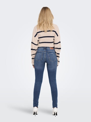 ONLY Skinny Jeans 'Forever' in Blue