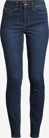 Orsay Jeans 'Jacky' in Blau: predná strana