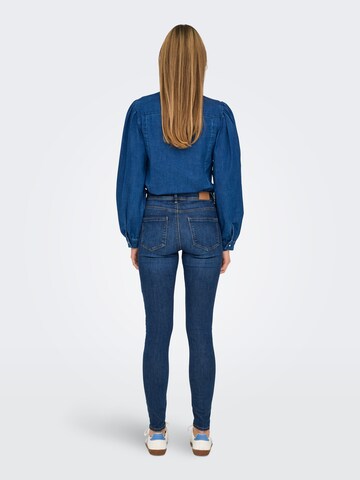 ONLY Skinny Fit Дънки 'ONLWauw' в синьо