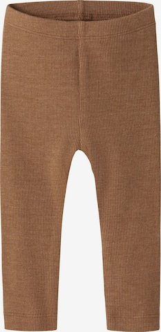 ruda NAME IT Siauras Tamprės 'NBNKAB': priekis