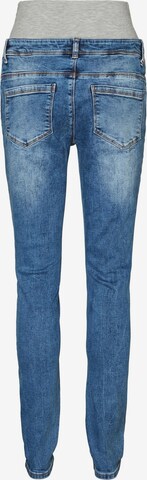 MAMALICIOUS Slimfit Jeans 'ROMA' in Blau