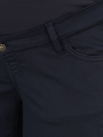 regular Pantaloni di LOVE2WAIT in blu