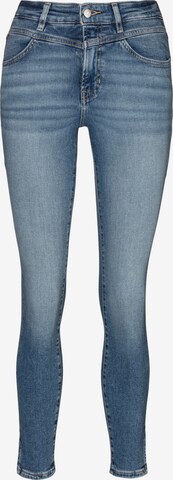 BOSS Skinny Jeans 'Kitt' in Blue: front