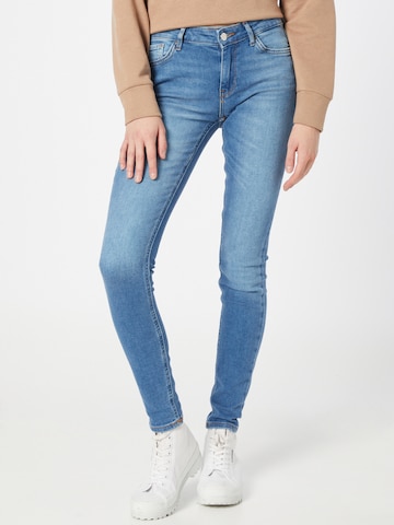 Skinny Jeans 'Carmen' de la ONLY pe albastru: față