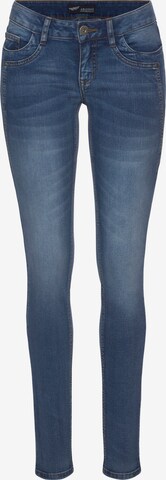 ARIZONA Skinny Jeans in Blue: front