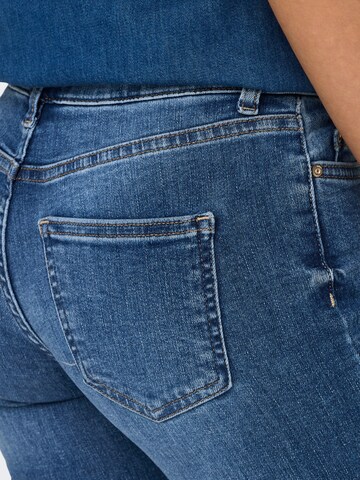 ONLY Skinny Jeans 'ONLBlush' in Blau
