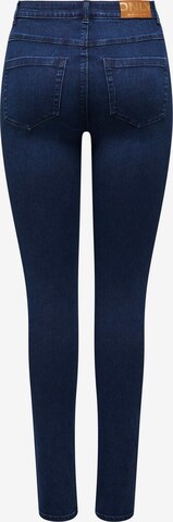 ONLY Skinny Jeans 'ROYAL' in Blauw