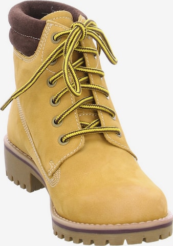 Franz Ferdinand Lace-Up Ankle Boots in Yellow