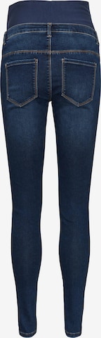 MAMALICIOUS Skinny Jeans 'Banda' in Blauw