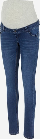 MAMALICIOUS Slimfit Jeans 'MLSARNIE ' i blå: forside
