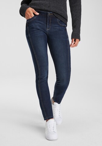 ARIZONA Skinny Jeans in Blue: front