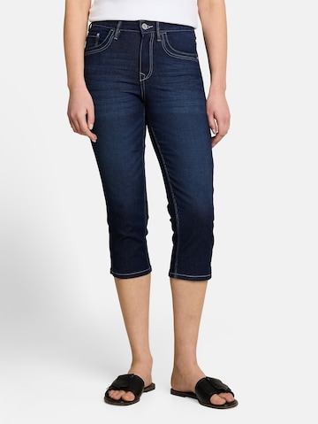 TOM TAILOR Slimfit Jeans in Blauw: voorkant