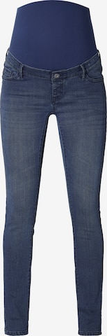 Supermom Jeans 'Austin' in Blauw: voorkant