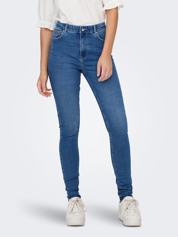 Skinny Jeans 'DRUNA' di ONLY in blu: frontale