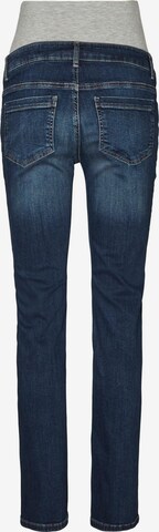 MAMALICIOUS Slimfit Jeans 'Sanne' in Blauw