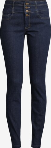 Orsay Jeans in Blue: front