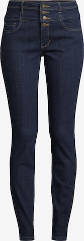 Orsay Slim fit Jeans in Blue: front